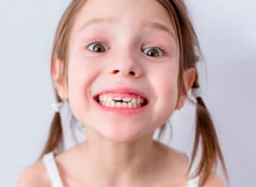 El agua fluorada también protege a los dientes de leche