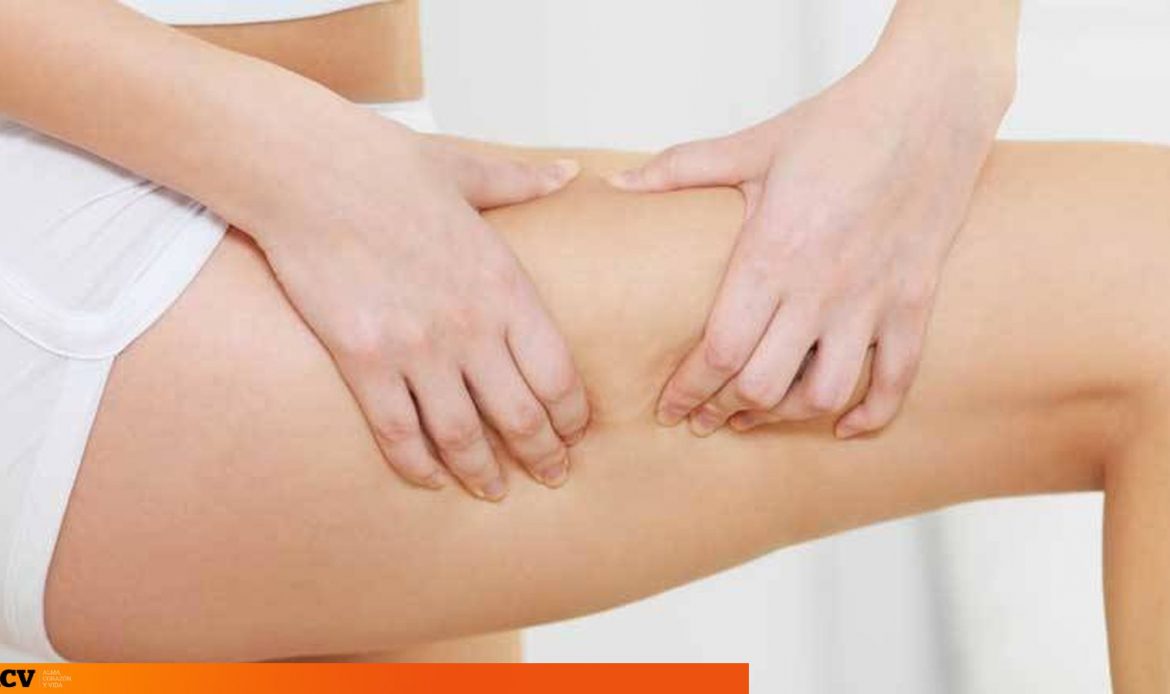 Consejos y remedios caseros para la retención de líquidos