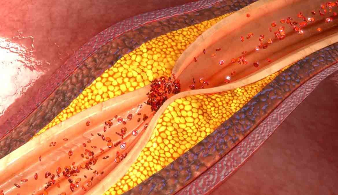 Alimentos que te ayudan a bajar los triglicéridos