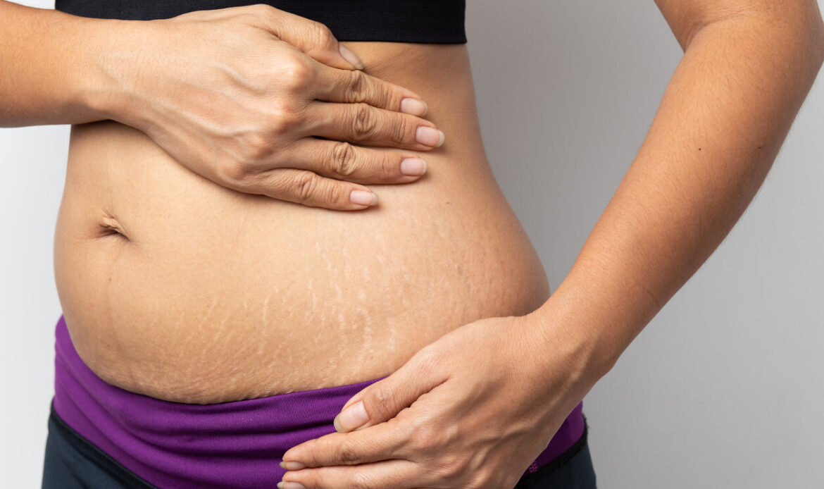 La piel en el postparto: cómo cambia y cómo debemos cuidarla