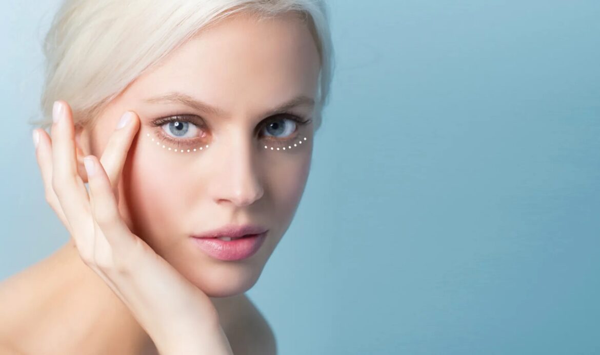 Las 3 recomendaciones de experto para prevenir y tratar las ojeras