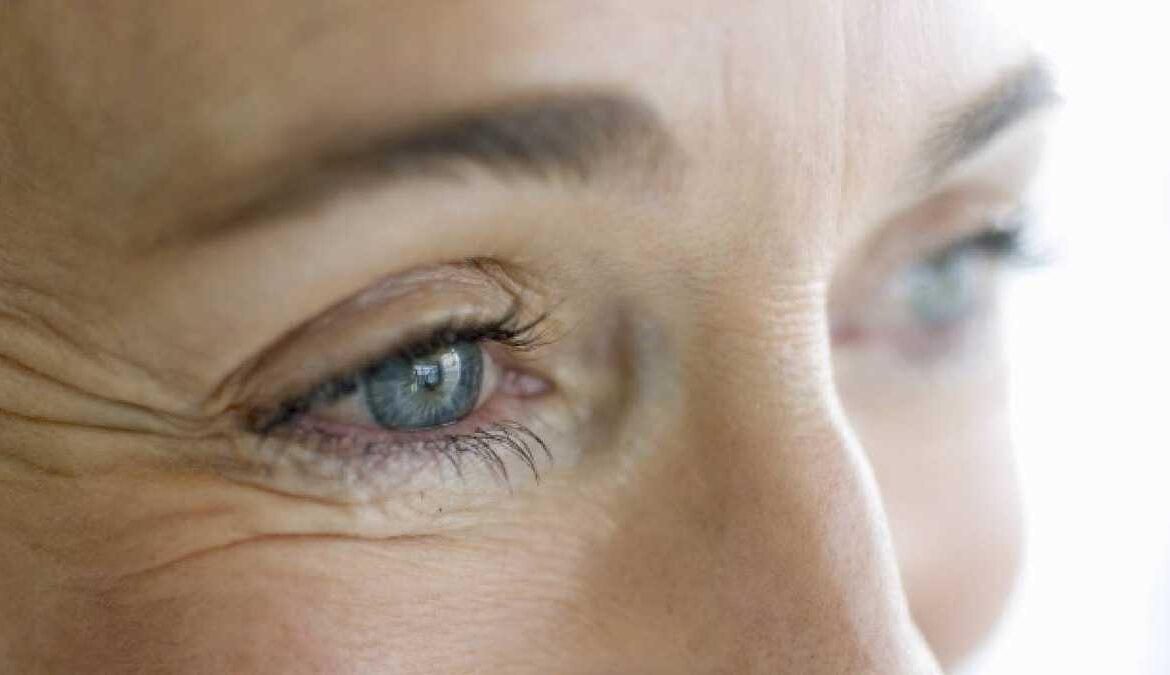 Tips para prevenir la aparición de patas de gallo en el contorno de los ojos