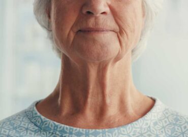 Arrugas en el cuello: así podrá eliminarlas con bicarbonato de sodio
