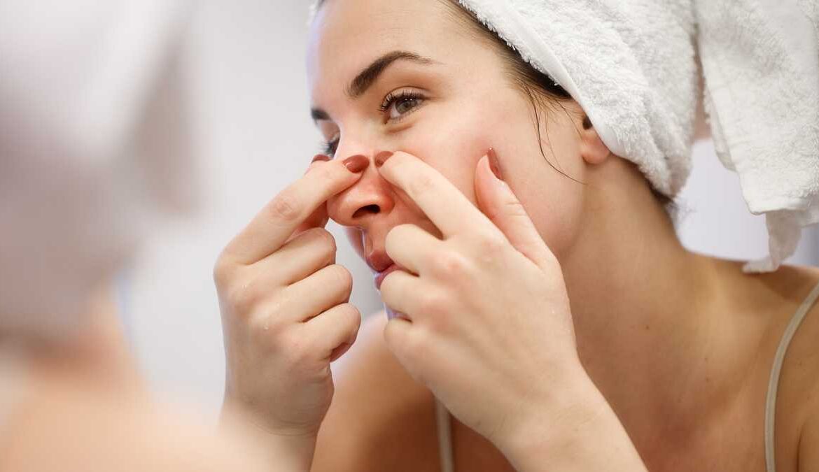 Puntos negros: trucos y consejos para eliminarlos de la nariz