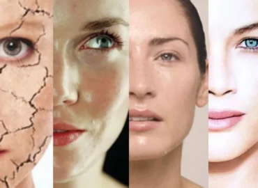 Los diferentes tipos de piel: cómo identificarlos y tips para saber como cuidarlos